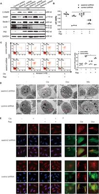 Corrigendum: Sestrin2-mediated autophagy contributes to drug resistance via endoplasmic reticulum stress in human osteosarcoma